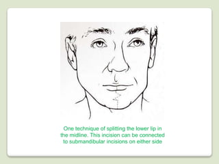 Surgical approaches to the facial skeleton | PPTX