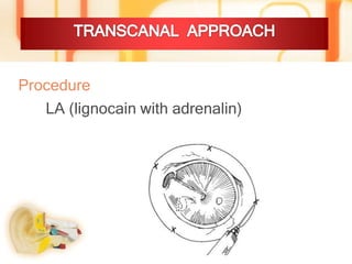 Surgical approach to middle ear,mastoid mamoon | PPTX