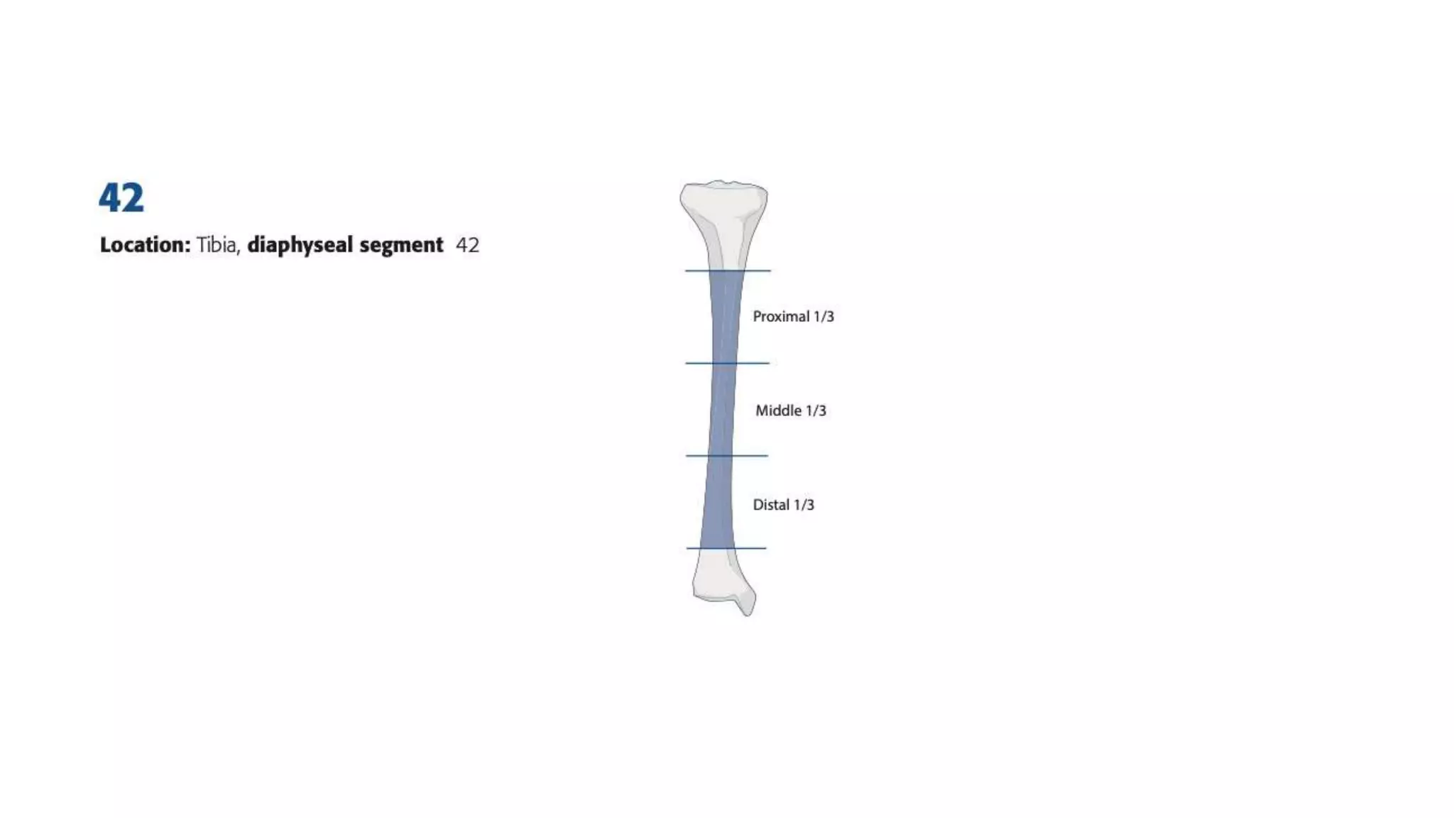 Surgical approaches tibia fibula | PPTX