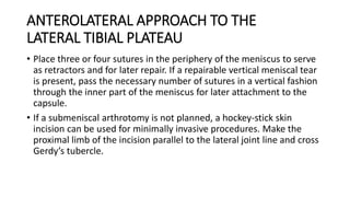ANTEROLATERAL APPROACH TO THE
LATERAL TIBIAL PLATEAU
• Place three or four sutures in the periphery of the meniscus to serve
as retractors and for later repair. If a repairable vertical meniscal tear
is present, pass the necessary number of sutures in a vertical fashion
through the inner part of the meniscus for later attachment to the
capsule.
• If a submeniscal arthrotomy is not planned, a hockey-stick skin
incision can be used for minimally invasive procedures. Make the
proximal limb of the incision parallel to the lateral joint line and cross
Gerdy’s tubercle.
 
