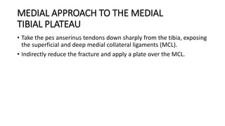 MEDIAL APPROACH TO THE MEDIAL
TIBIAL PLATEAU
• Take the pes anserinus tendons down sharply from the tibia, exposing
the superficial and deep medial collateral ligaments (MCL).
• Indirectly reduce the fracture and apply a plate over the MCL.
 