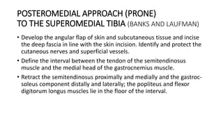 POSTEROMEDIAL APPROACH (PRONE)
TO THE SUPEROMEDIAL TIBIA (BANKS AND LAUFMAN)
• Develop the angular flap of skin and subcutaneous tissue and incise
the deep fascia in line with the skin incision. Identify and protect the
cutaneous nerves and superficial vessels.
• Define the interval between the tendon of the semitendinosus
muscle and the medial head of the gastrocnemius muscle.
• Retract the semitendinosus proximally and medially and the gastroc-
soleus component distally and laterally; the popliteus and flexor
digitorum longus muscles lie in the floor of the interval.
 