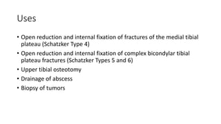 Uses
• Open reduction and internal fixation of fractures of the medial tibial
plateau (Schatzker Type 4)
• Open reduction and internal fixation of complex bicondylar tibial
plateau fractures (Schatzker Types 5 and 6)
• Upper tibial osteotomy
• Drainage of abscess
• Biopsy of tumors
 