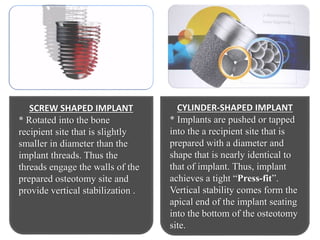 Tap Tooth Shape Surgical aspect of Dental Implants.pptx