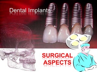 Dental Implants
SURGICAL
ASPECTS
 
