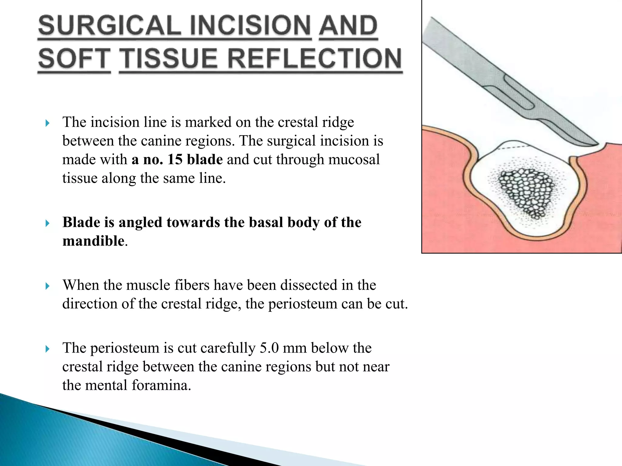  The incision line is marked on the crestal ridge
between the canine regions. The surgical incision is
made with a no. 15 blade and cut through mucosal
tissue along the same line.
 Blade is angled towards the basal body of the
mandible.
 When the muscle fibers have been dissected in the
direction of the crestal ridge, the periosteum can be cut.
 The periosteum is cut carefully 5.0 mm below the
crestal ridge between the canine regions but not near
the mental foramina.
 