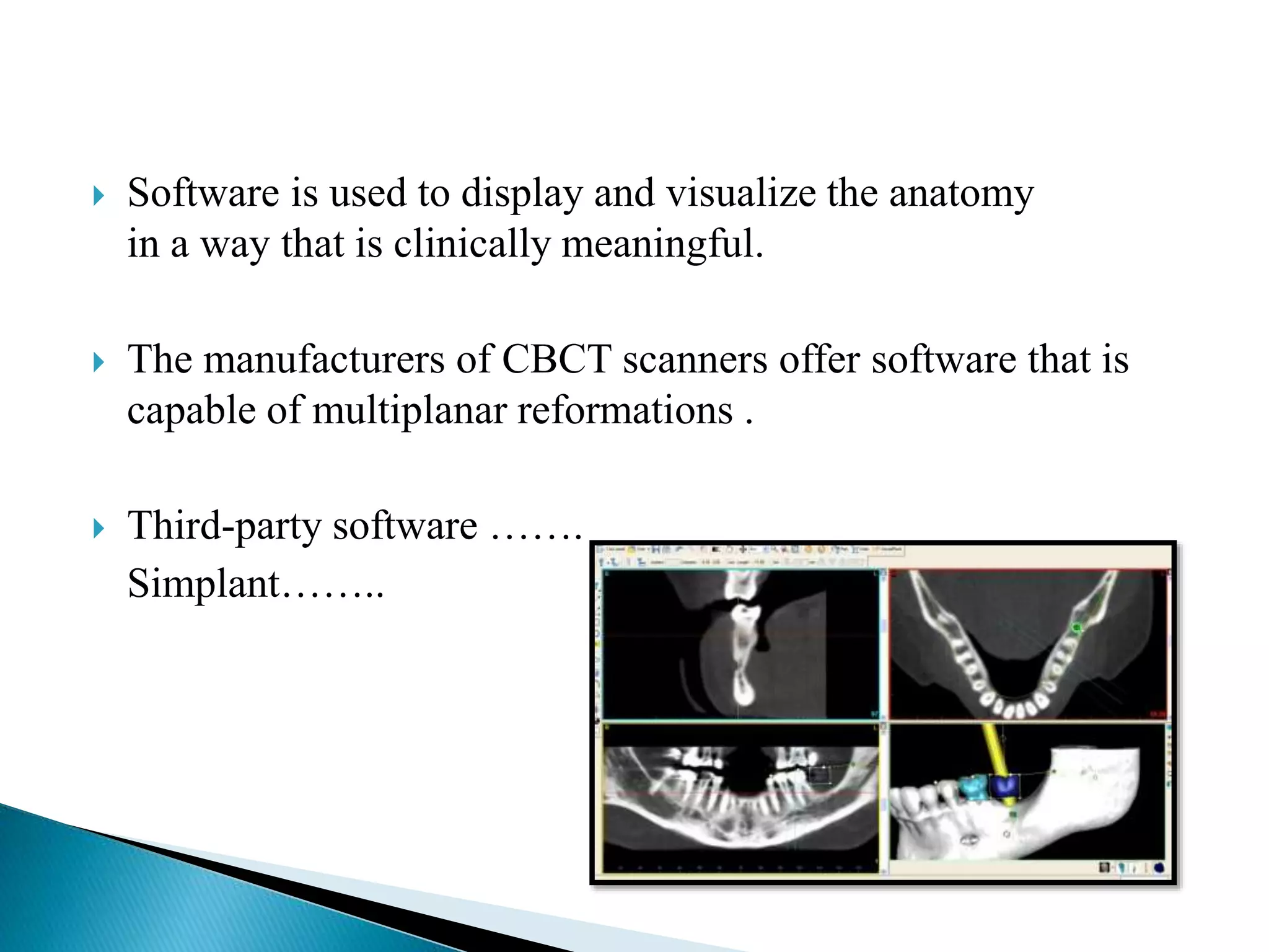  Software is used to display and visualize the anatomy
in a way that is clinically meaningful.
 The manufacturers of CBCT scanners offer software that is
capable of multiplanar reformations .
 Third-party software …….
Simplant……..
 