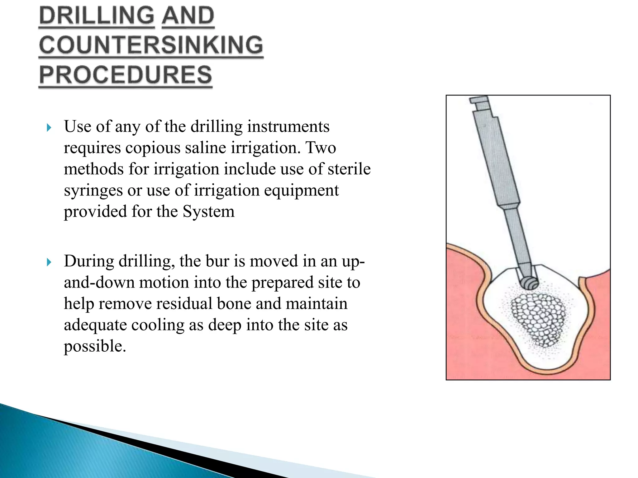  Use of any of the drilling instruments
requires copious saline irrigation. Two
methods for irrigation include use of sterile
syringes or use of irrigation equipment
provided for the System
 During drilling, the bur is moved in an up-
and-down motion into the prepared site to
help remove residual bone and maintain
adequate cooling as deep into the site as
possible.
 