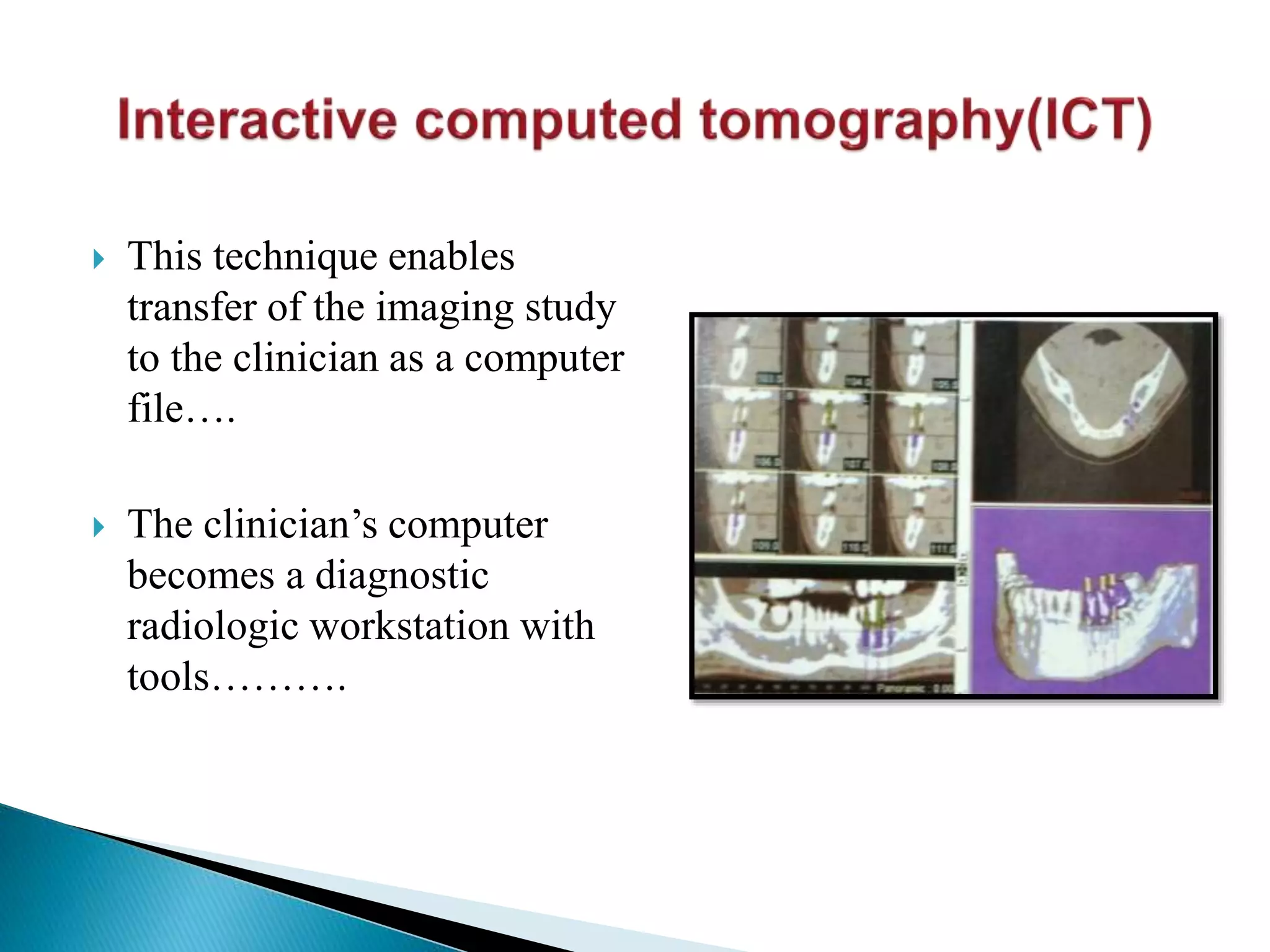  This technique enables
transfer of the imaging study
to the clinician as a computer
file….
 The clinician’s computer
becomes a diagnostic
radiologic workstation with
tools……….
 
