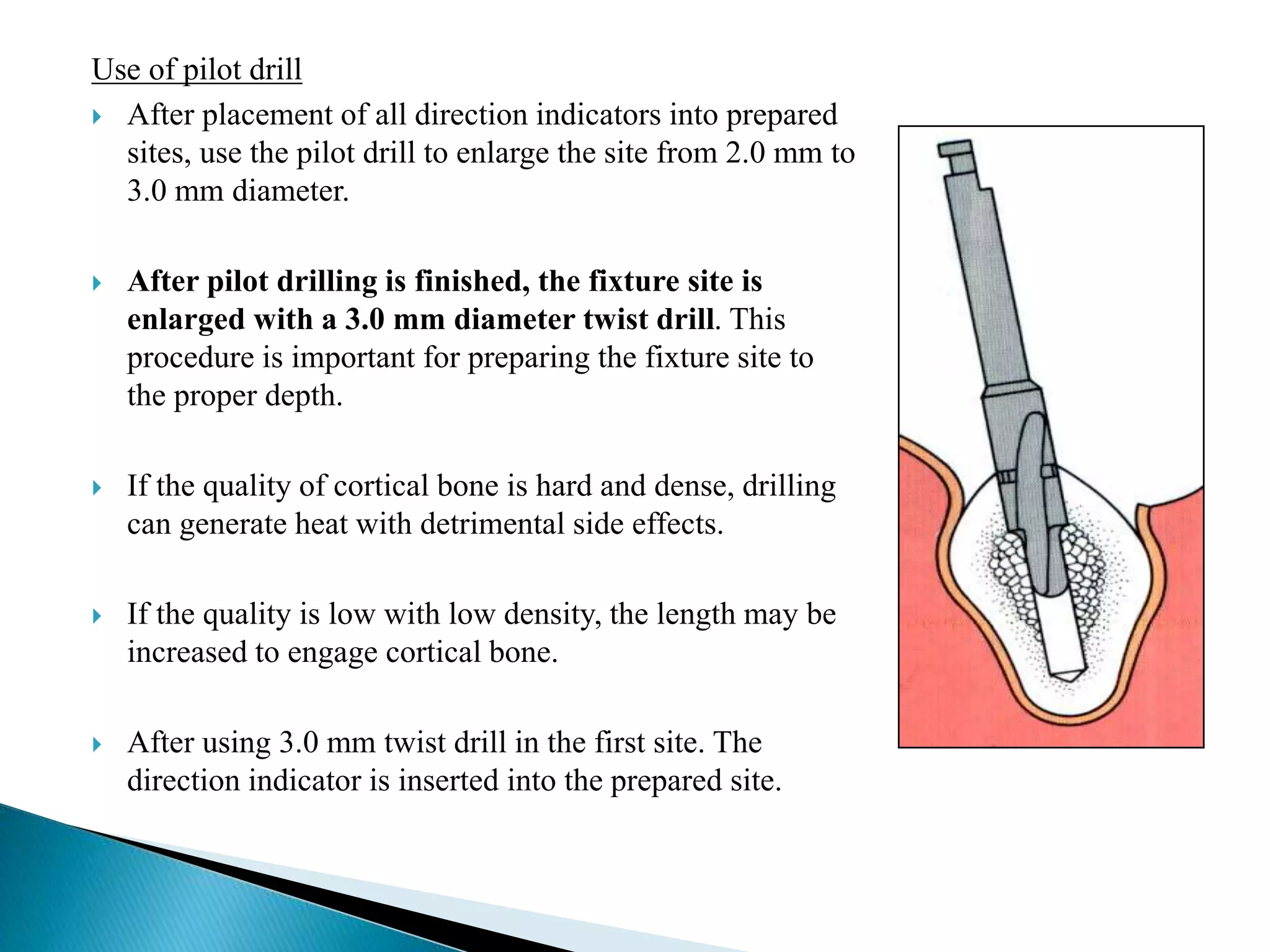 Use of pilot drill
 After placement of all direction indicators into prepared
sites, use the pilot drill to enlarge the site from 2.0 mm to
3.0 mm diameter.
 After pilot drilling is finished, the fixture site is
enlarged with a 3.0 mm diameter twist drill. This
procedure is important for preparing the fixture site to
the proper depth.
 If the quality of cortical bone is hard and dense, drilling
can generate heat with detrimental side effects.
 If the quality is low with low density, the length may be
increased to engage cortical bone.
 After using 3.0 mm twist drill in the first site. The
direction indicator is inserted into the prepared site.
 