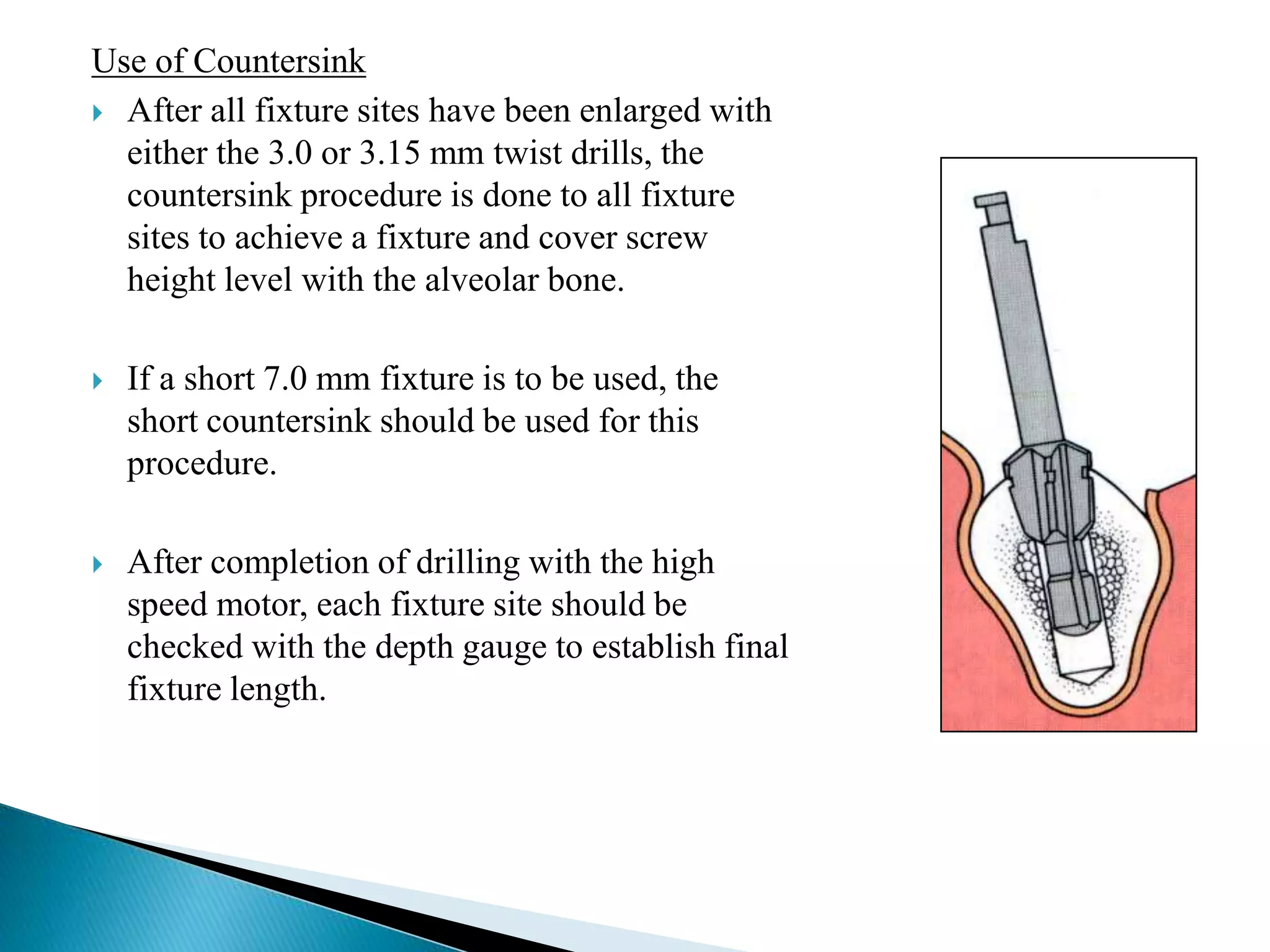 Use of Countersink
 After all fixture sites have been enlarged with
either the 3.0 or 3.15 mm twist drills, the
countersink procedure is done to all fixture
sites to achieve a fixture and cover screw
height level with the alveolar bone.
 If a short 7.0 mm fixture is to be used, the
short countersink should be used for this
procedure.
 After completion of drilling with the high
speed motor, each fixture site should be
checked with the depth gauge to establish final
fixture length.
 
