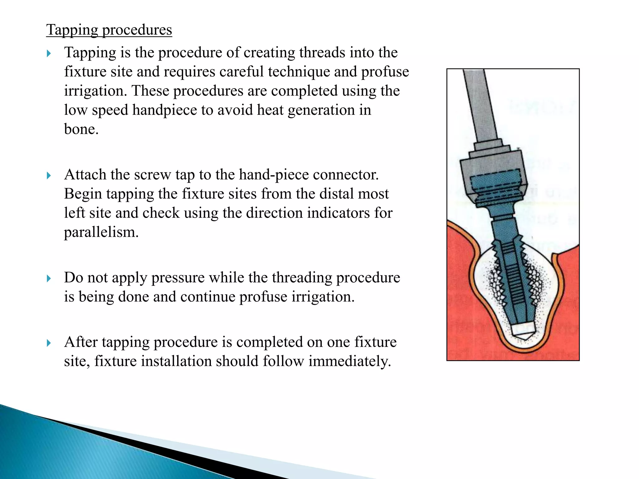 Tapping procedures
 Tapping is the procedure of creating threads into the
fixture site and requires careful technique and profuse
irrigation. These procedures are completed using the
low speed handpiece to avoid heat generation in
bone.
 Attach the screw tap to the hand-piece connector.
Begin tapping the fixture sites from the distal most
left site and check using the direction indicators for
parallelism.
 Do not apply pressure while the threading procedure
is being done and continue profuse irrigation.
 After tapping procedure is completed on one fixture
site, fixture installation should follow immediately.
 