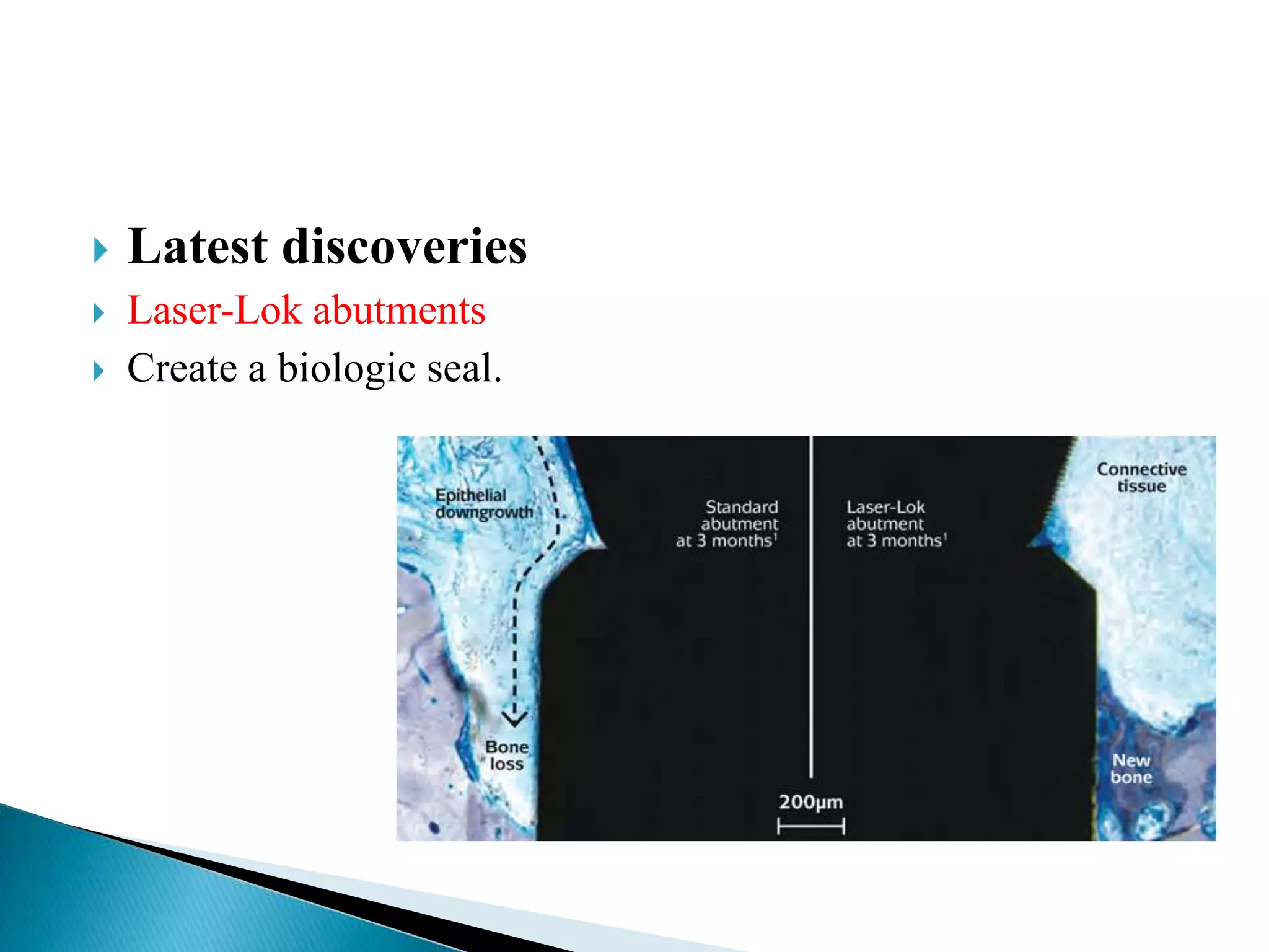  Latest discoveries
 Laser-Lok abutments
 Create a biologic seal.
 