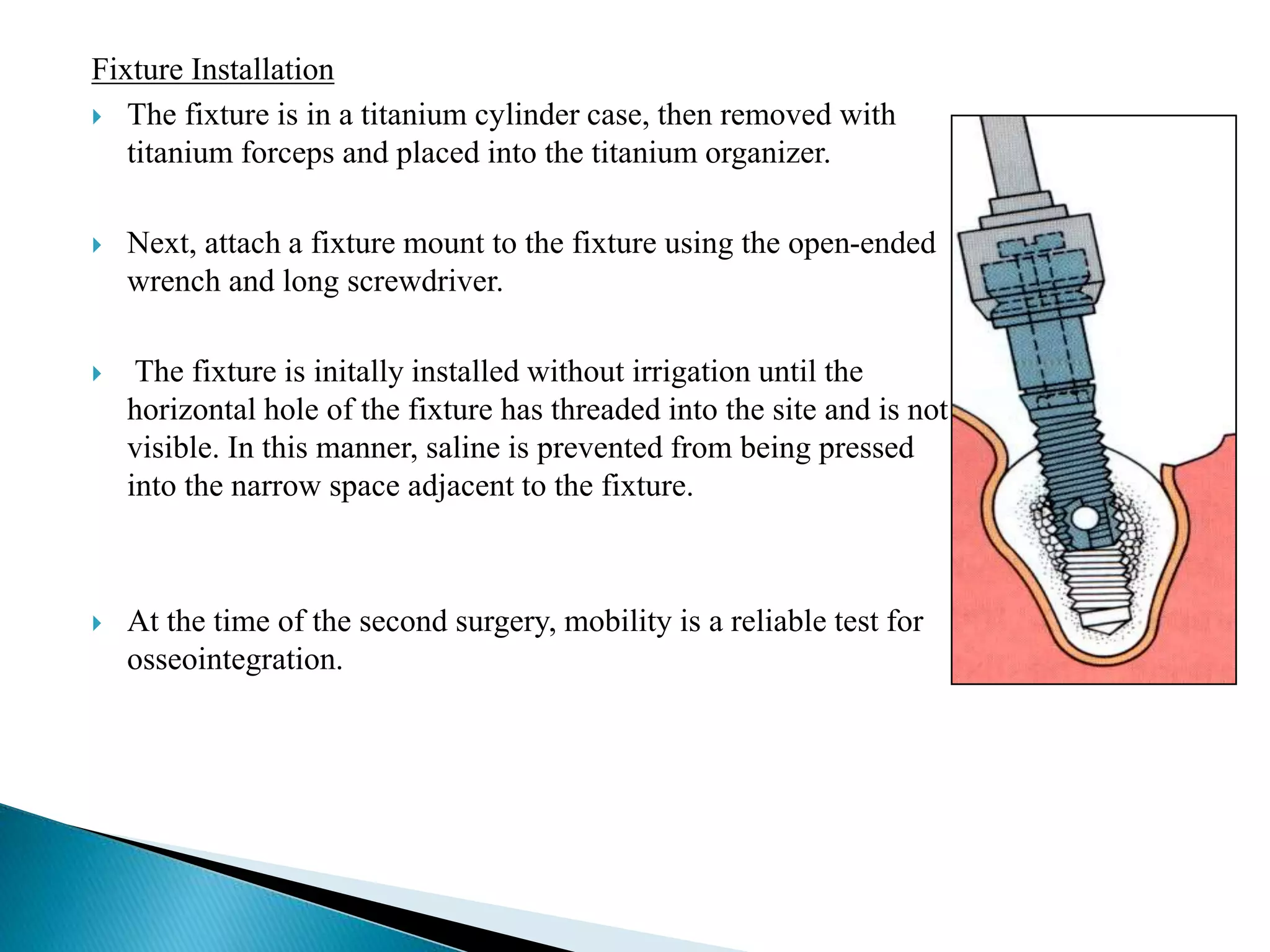 Fixture Installation
 The fixture is in a titanium cylinder case, then removed with
titanium forceps and placed into the titanium organizer.
 Next, attach a fixture mount to the fixture using the open-ended
wrench and long screwdriver.
 The fixture is initally installed without irrigation until the
horizontal hole of the fixture has threaded into the site and is not
visible. In this manner, saline is prevented from being pressed
into the narrow space adjacent to the fixture.
 At the time of the second surgery, mobility is a reliable test for
osseointegration.
 