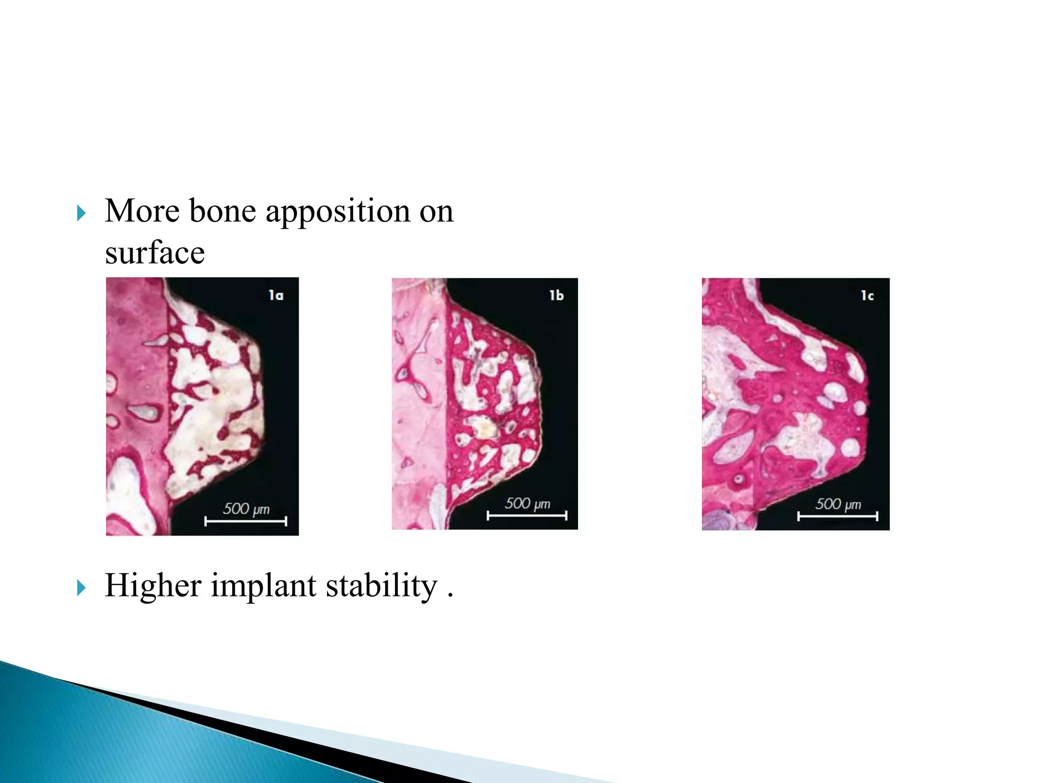  More bone apposition on
surface
 Higher implant stability .
 