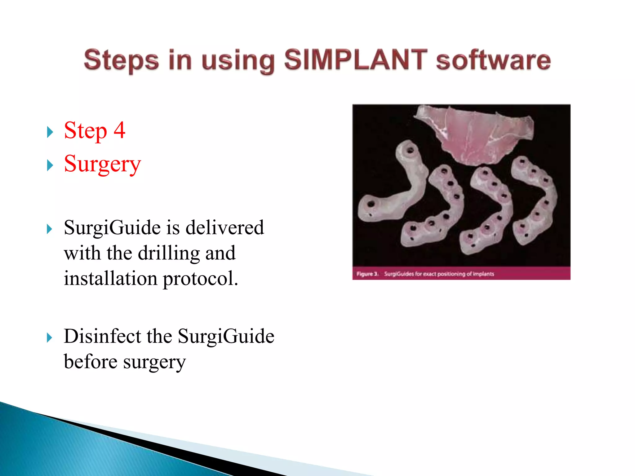  Step 4
 Surgery
 SurgiGuide is delivered
with the drilling and
installation protocol.
 Disinfect the SurgiGuide
before surgery
 
