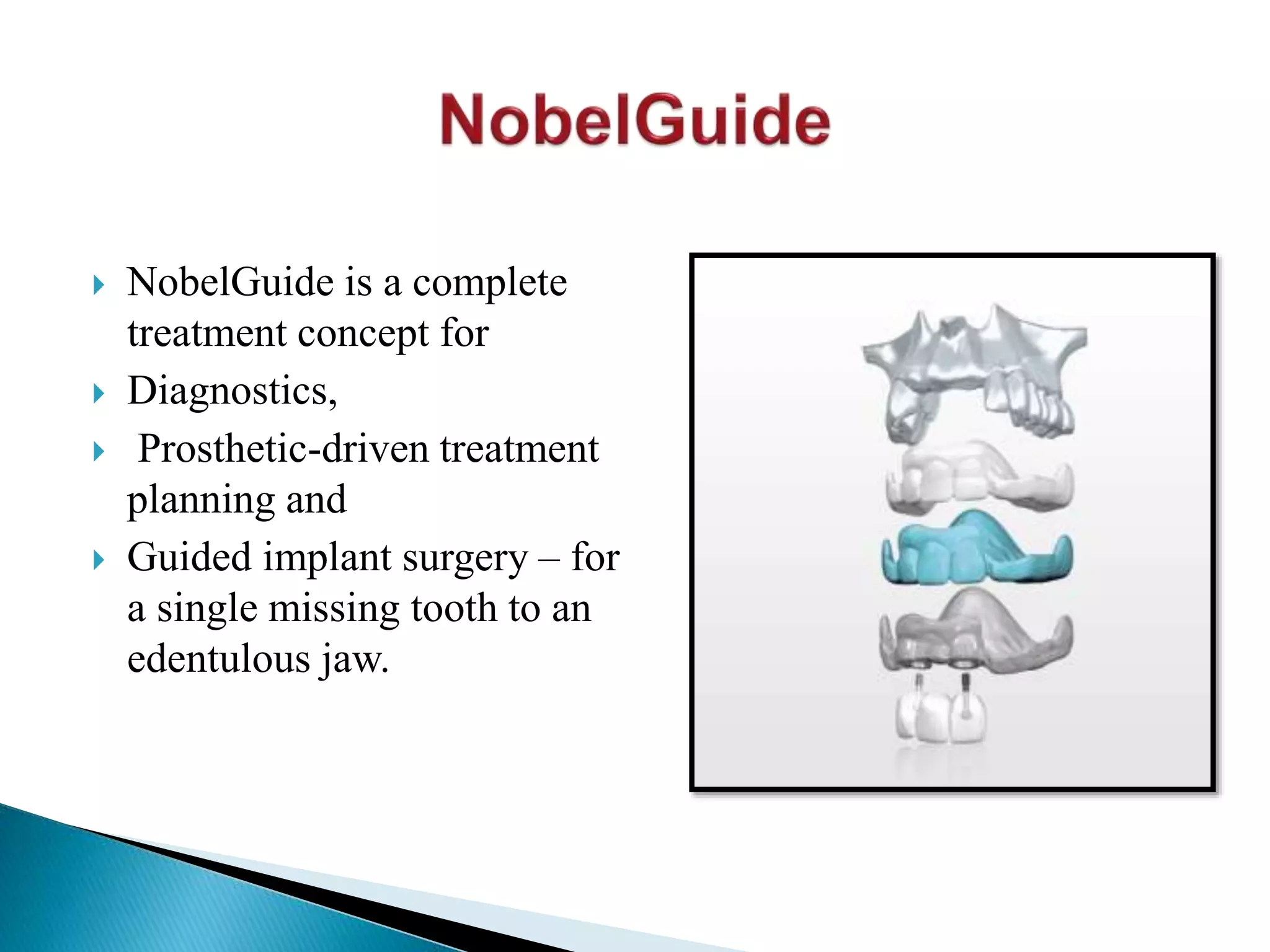 NobelGuide is a complete
treatment concept for
 Diagnostics,
 Prosthetic-driven treatment
planning and
 Guided implant surgery – for
a single missing tooth to an
edentulous jaw.
 