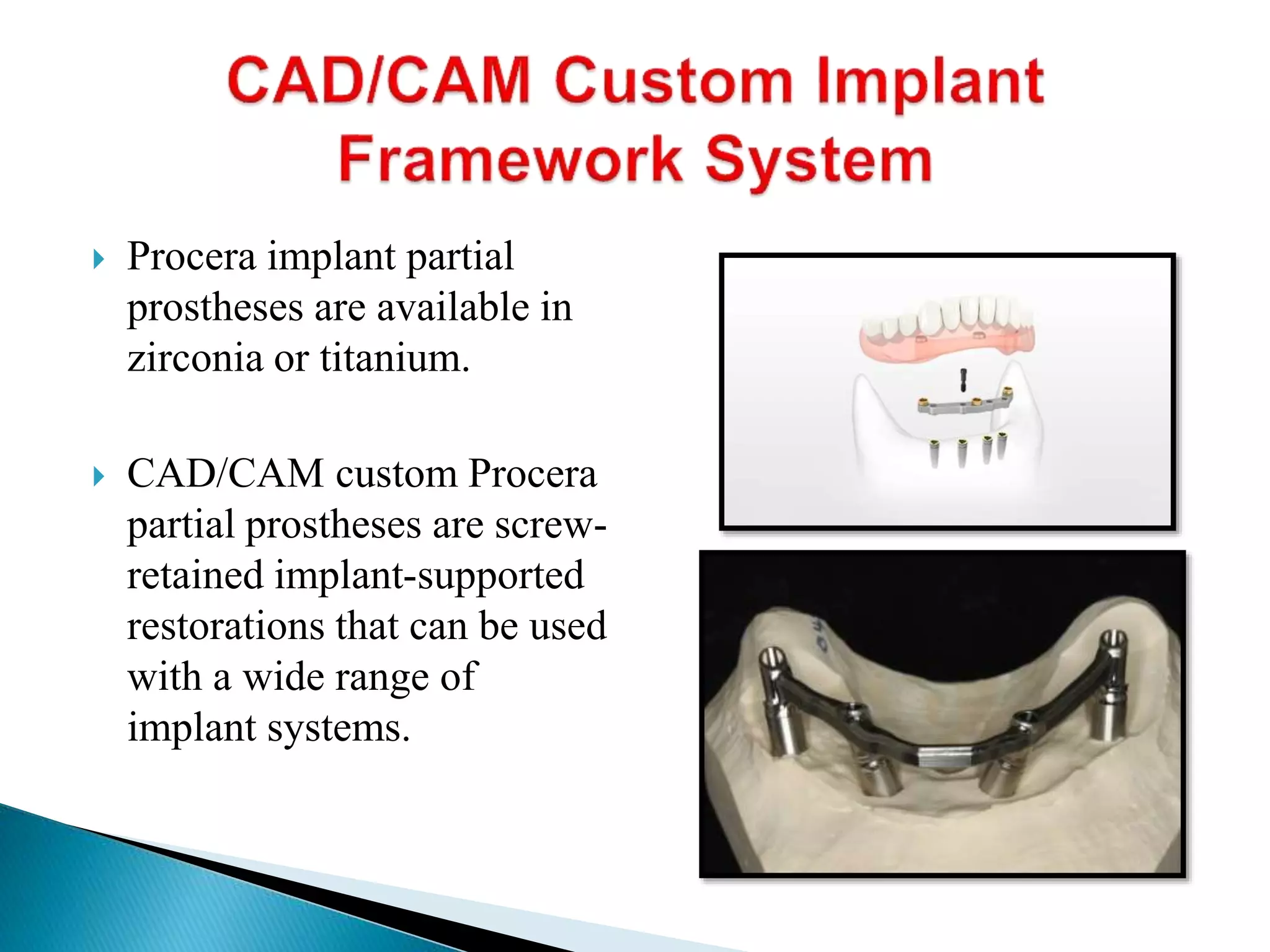  Procera implant partial
prostheses are available in
zirconia or titanium.
 CAD/CAM custom Procera
partial prostheses are screw-
retained implant-supported
restorations that can be used
with a wide range of
implant systems.
 