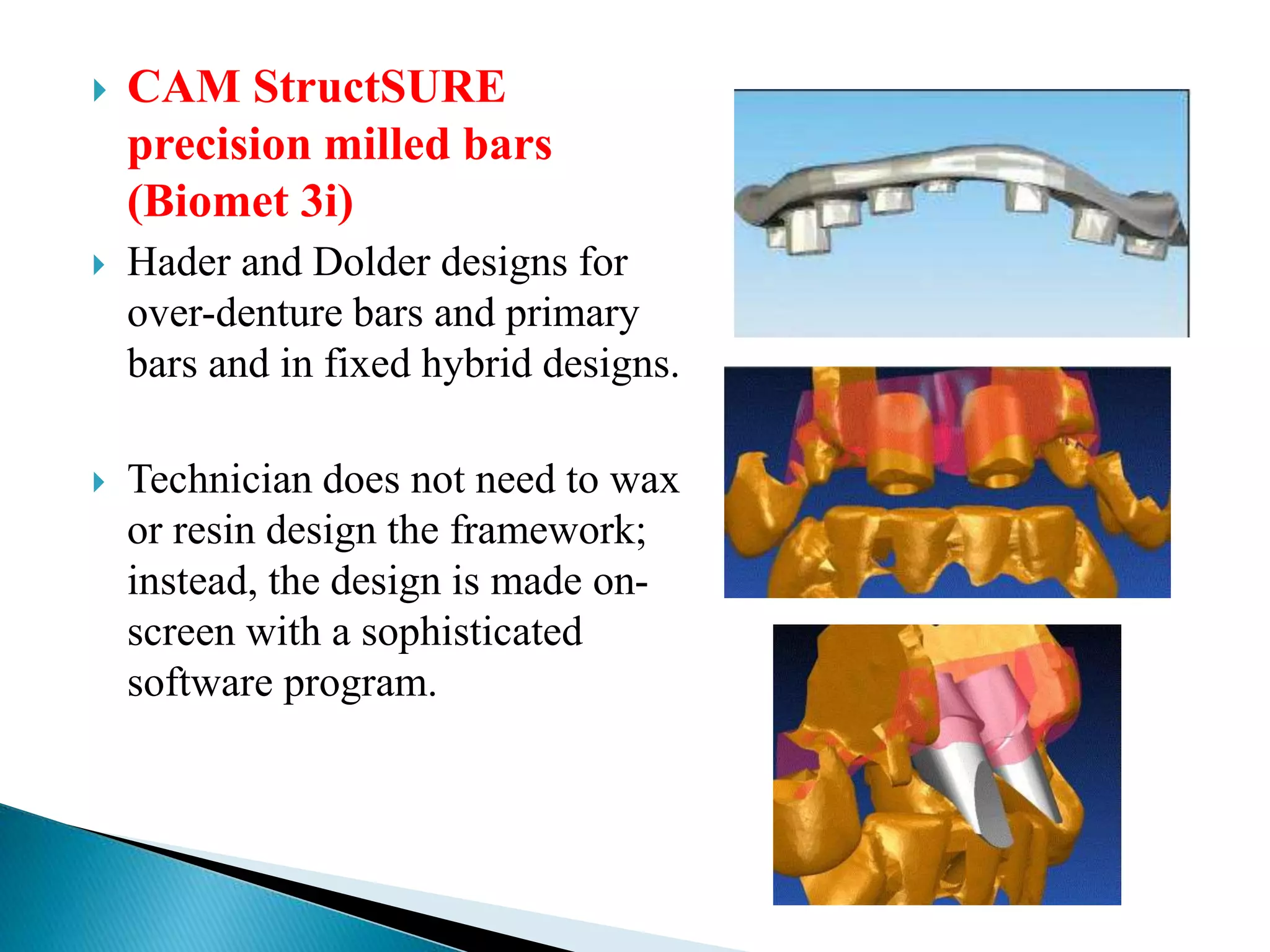  CAM StructSURE
precision milled bars
(Biomet 3i)
 Hader and Dolder designs for
over-denture bars and primary
bars and in fixed hybrid designs.
 Technician does not need to wax
or resin design the framework;
instead, the design is made on-
screen with a sophisticated
software program.
 