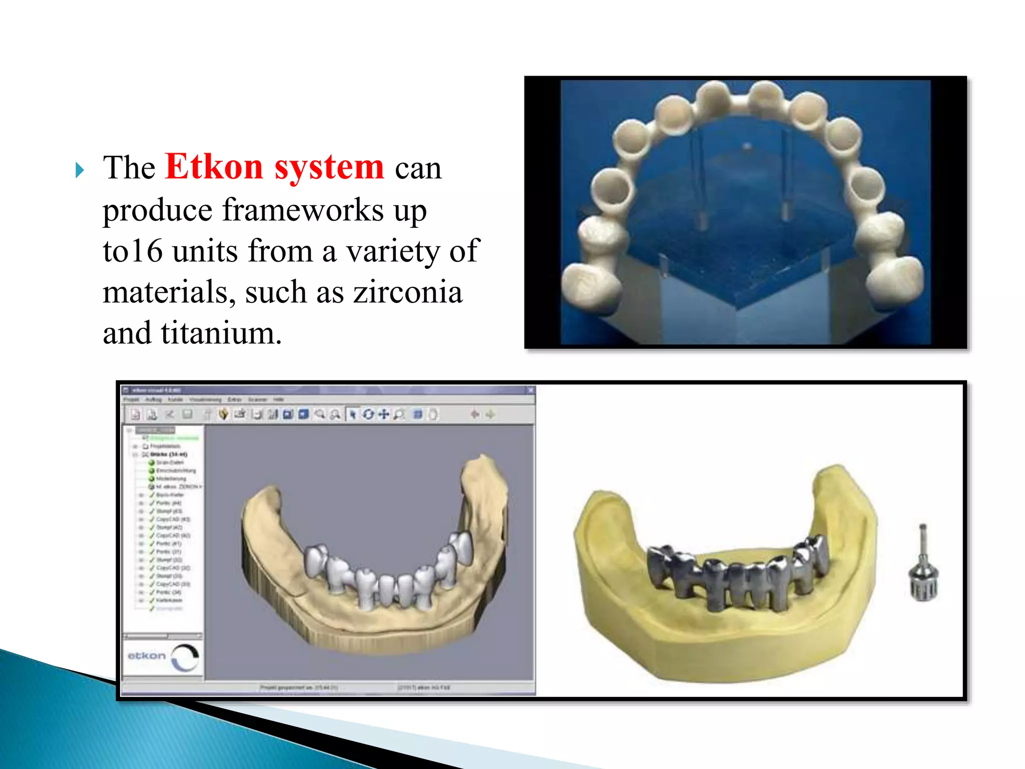  The Etkon system can
produce frameworks up
to16 units from a variety of
materials, such as zirconia
and titanium.
 