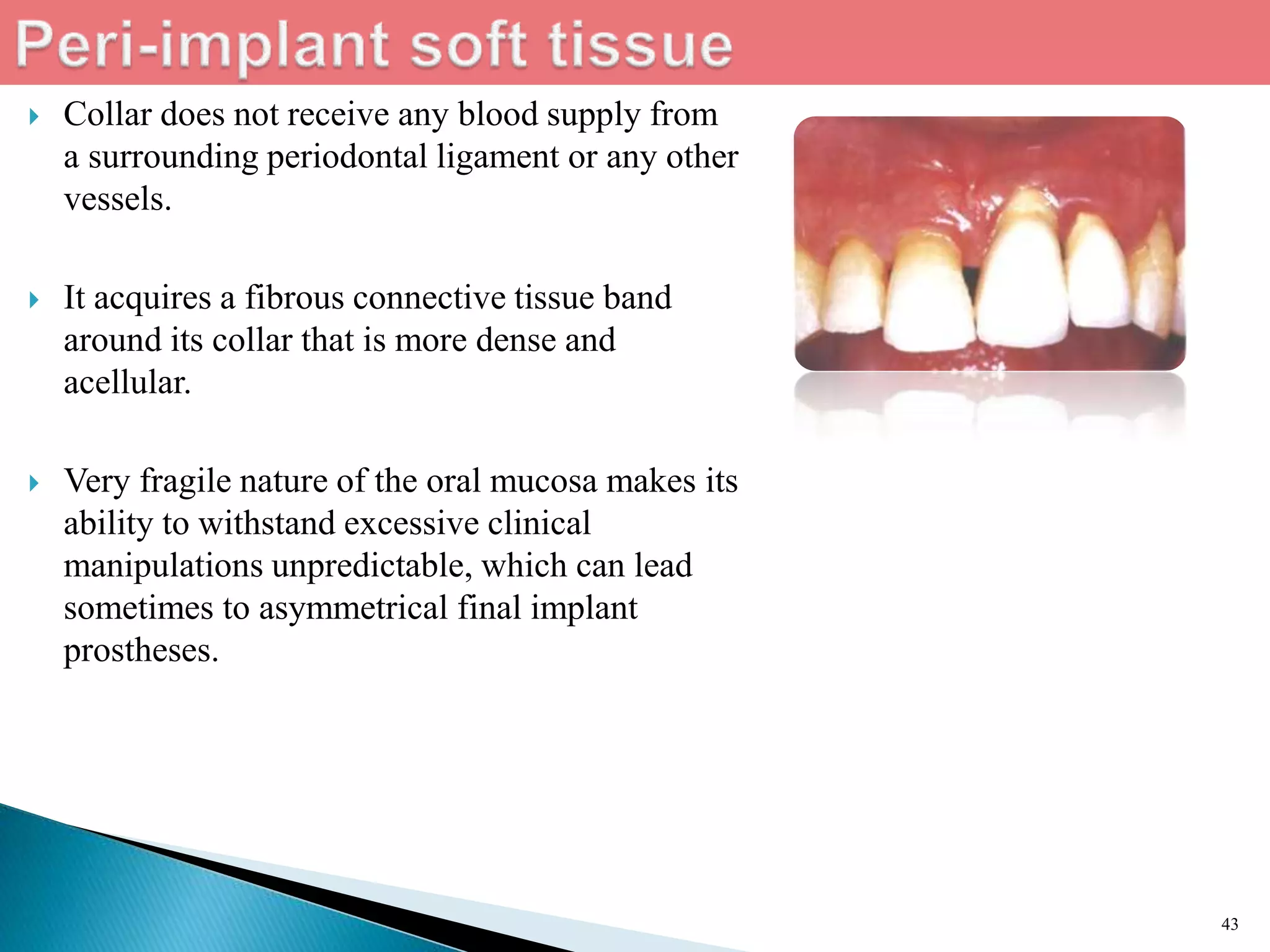  Collar does not receive any blood supply from
a surrounding periodontal ligament or any other
vessels.
 It acquires a fibrous connective tissue band
around its collar that is more dense and
acellular.
 Very fragile nature of the oral mucosa makes its
ability to withstand excessive clinical
manipulations unpredictable, which can lead
sometimes to asymmetrical final implant
prostheses.
43
 