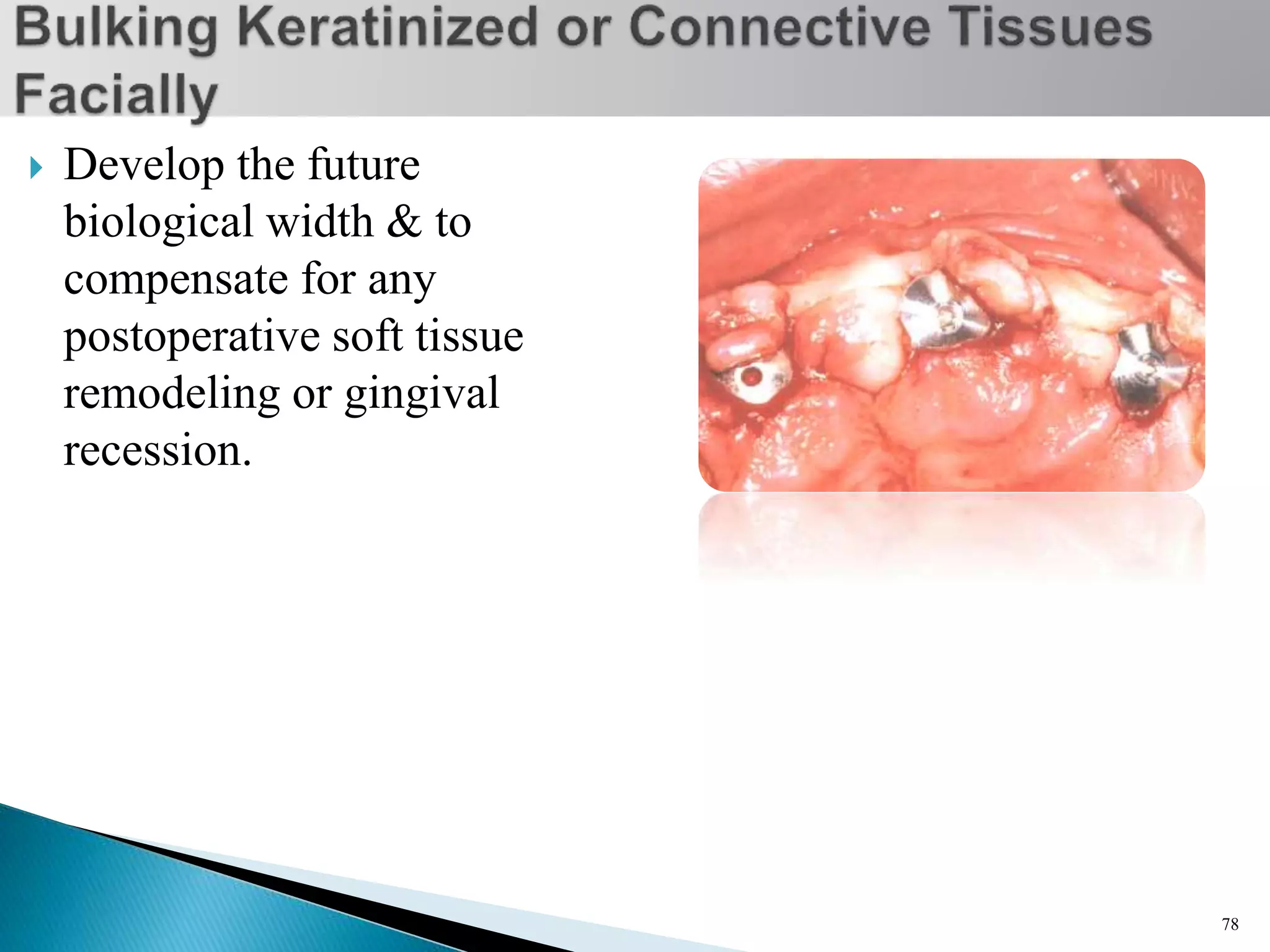  Develop the future
biological width & to
compensate for any
postoperative soft tissue
remodeling or gingival
recession.
78
 
