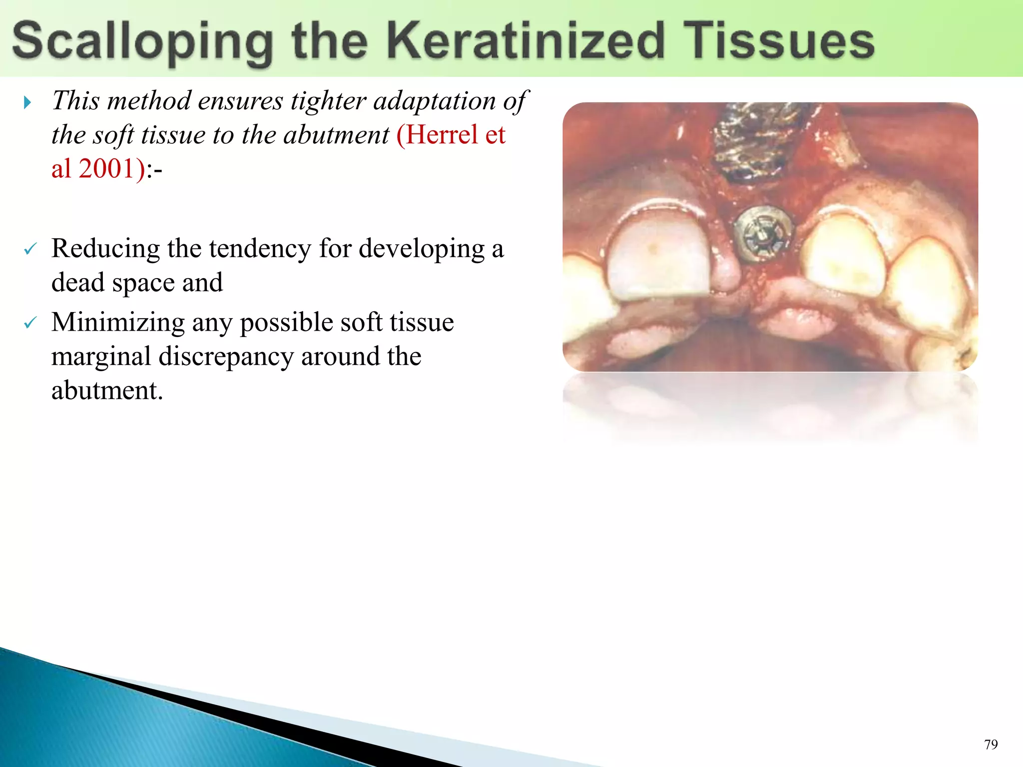  This method ensures tighter adaptation of
the soft tissue to the abutment (Herrel et
al 2001):-
 Reducing the tendency for developing a
dead space and
 Minimizing any possible soft tissue
marginal discrepancy around the
abutment.
79
 