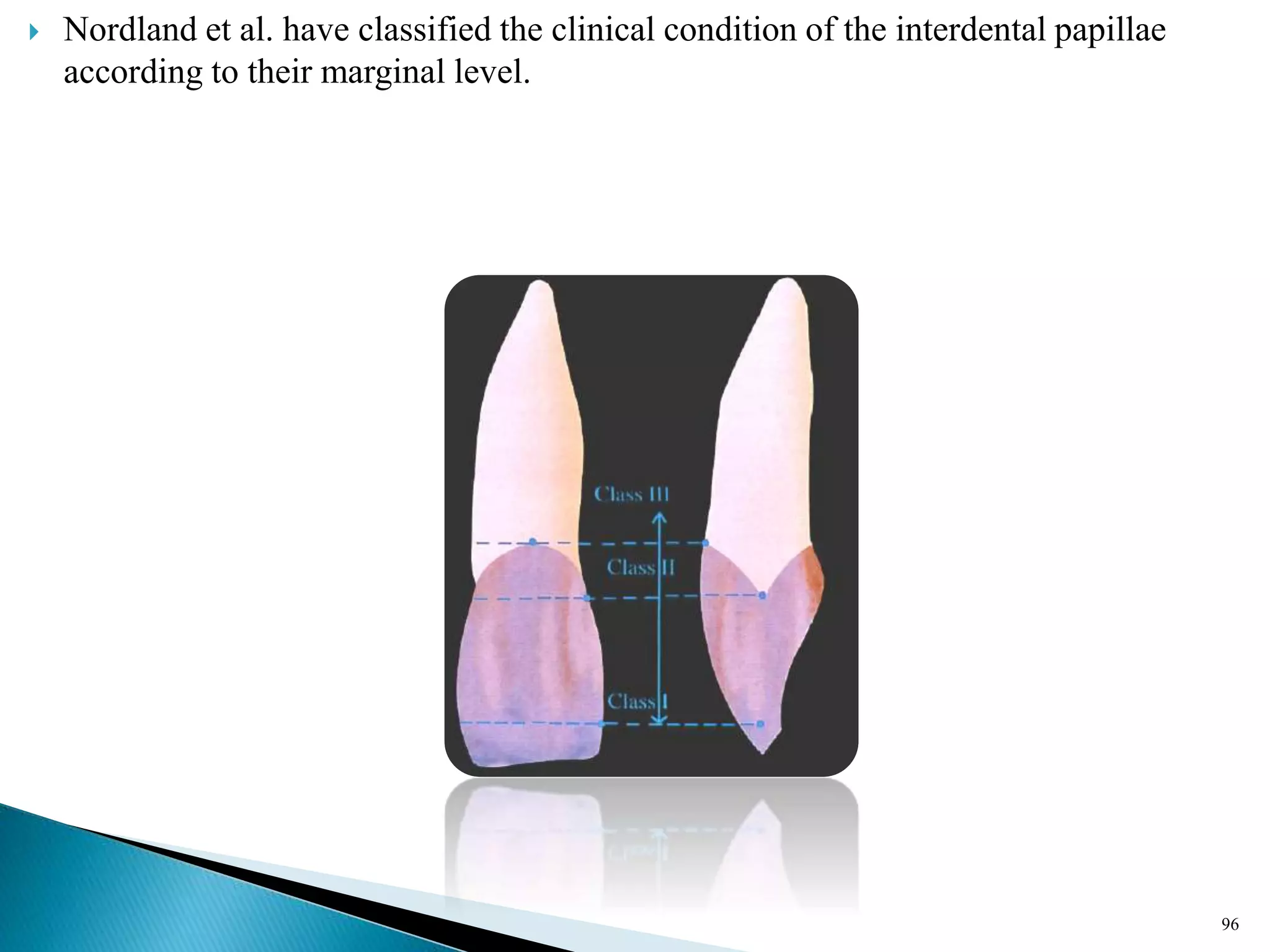  Nordland et al. have classified the clinical condition of the interdental papillae
according to their marginal level.
96
 