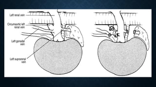 Surgical aspects complications of renal transplant.pptx