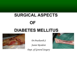SURGICAL ASPECTS
OF
DIABETES MELLITUS
Dr.Prashanth.S
Junior Resident
Dept. of General Surgery
 