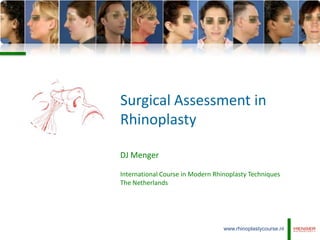 Surgical Assessment in
Rhinoplasty

DJ Menger

International Course in Modern Rhinoplasty Techniques
The Netherlands




                                  www.rhinoplastycourse.nl
 