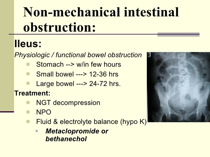 Surgical Complications