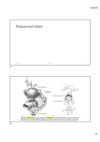 Paracervical Lock Surgical consideration | PDF