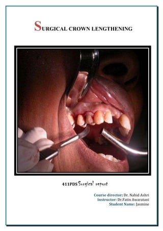 SURGICAL CROWN LENGTHENING ,[object Object],Course director: Dr. Nahid Ashri Instructor: Dr.Fatin Awaratani Student Name: Jasmine  ,[object Object],       Crown lengthening: is a surgical procedure performed on a healthy periodontium that requires exposure of adequate tooth structure (so, the amount of tooth exposed supragingivally is increased) for restorative purposes. This may be achieved by several techniques (either orthodontically or surgically) depending upon: 5955030183515 ,[object Object]