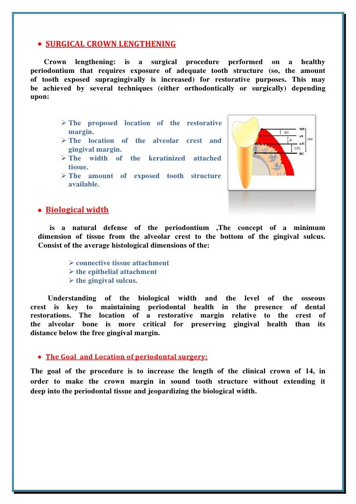 Surgical Crown Lengthening 2
