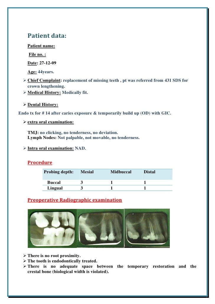Surgical Crown Lengthening 2