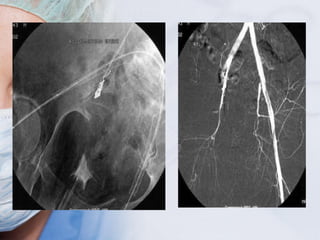 Tac Line Surgical drains, tube, catheters and central lines | PPT
