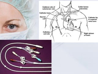 Tac Line Surgical drains, tube, catheters and central lines | PPT