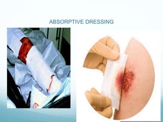 ABSORPTIVE DRESSING
 