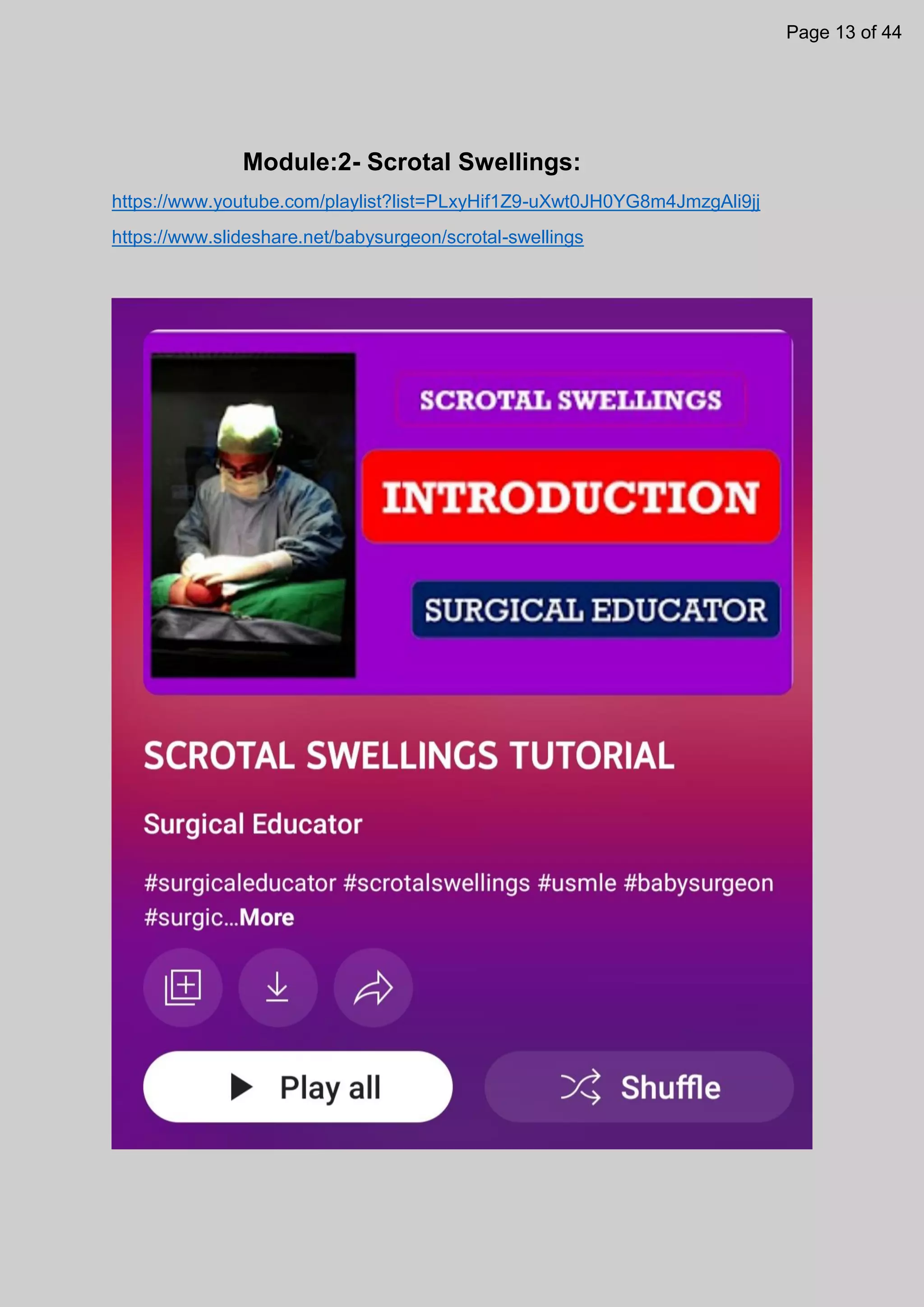 Module:2- Scrotal Swellings:
https://www.youtube.com/playlist?list=PLxyHif1Z9-uXwt0JH0YG8m4JmzgAli9jj
https://www.slideshare.net/babysurgeon/scrotal-swellings
Page 13 of 44
 