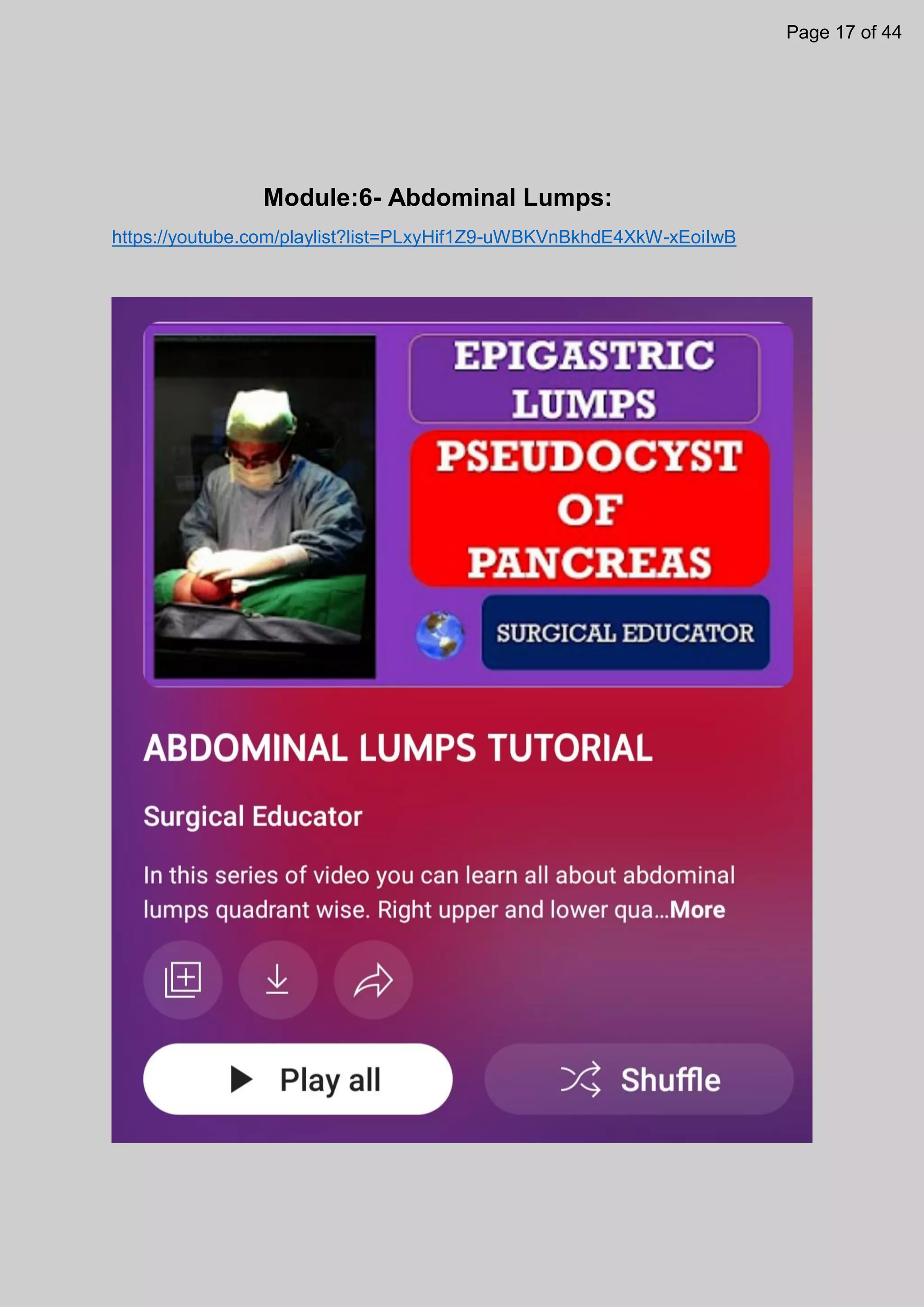 Module:6- Abdominal Lumps:
https://youtube.com/playlist?list=PLxyHif1Z9-uWBKVnBkhdE4XkW-xEoiIwB
Page 17 of 44
 
