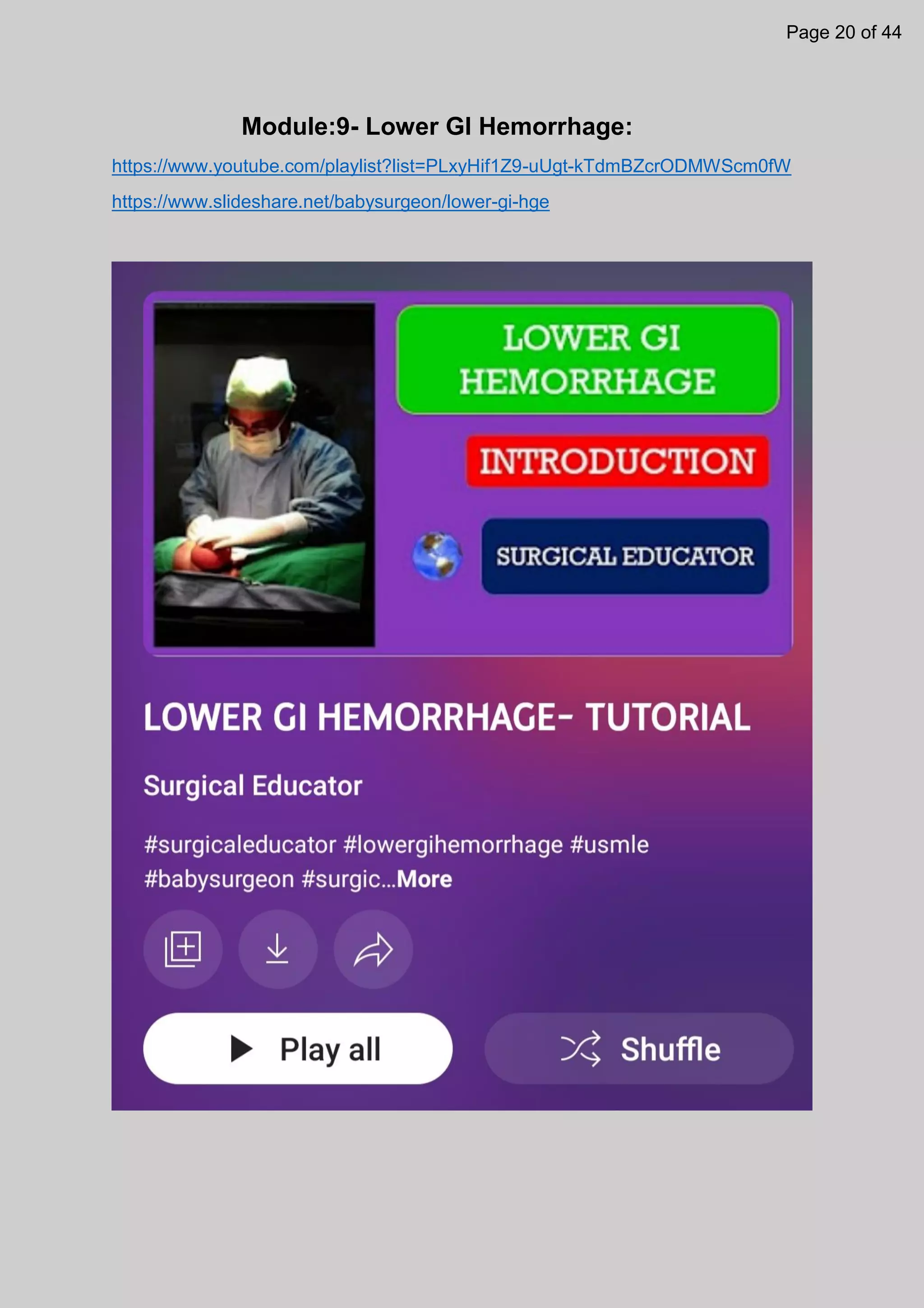 Module:9- Lower GI Hemorrhage:
https://www.youtube.com/playlist?list=PLxyHif1Z9-uUgt-kTdmBZcrODMWScm0fW
https://www.slideshare.net/babysurgeon/lower-gi-hge
Page 20 of 44
 