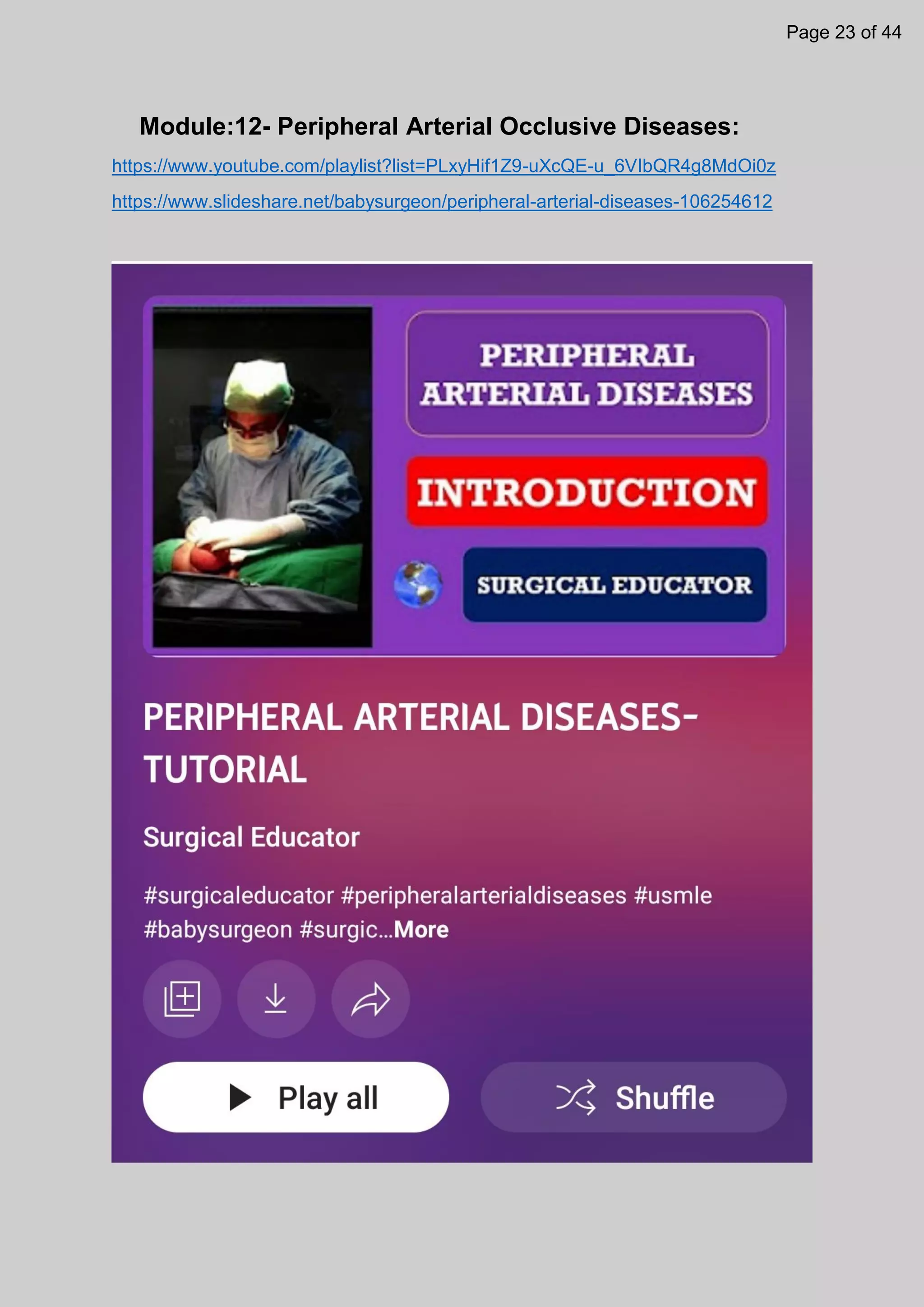 Module:12- Peripheral Arterial Occlusive Diseases:
https://www.youtube.com/playlist?list=PLxyHif1Z9-uXcQE-u_6VIbQR4g8MdOi0z
https://www.slideshare.net/babysurgeon/peripheral-arterial-diseases-106254612
Page 23 of 44
 