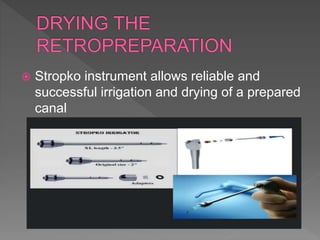  Stropko instrument allows reliable and
successful irrigation and drying of a prepared
canal
 