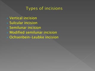  Vertical incision
 Sulcular incision
 Semilunar incision
 Modified semilunar incision
 Ochsenbein-Leubke incision
 