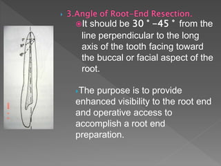 It should be 30 ° -45 ° from the
line perpendicular to the long
axis of the tooth facing toward
the buccal or facial aspect of the
root.
The purpose is to provide
enhanced visibility to the root end
and operative access to
accomplish a root end
preparation.
 