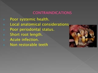  Poor systemic health.
 Local anatomical considerations
 Poor periodontal status.
 Short root length.
 Acute infection.
 Non restorable teeth
 