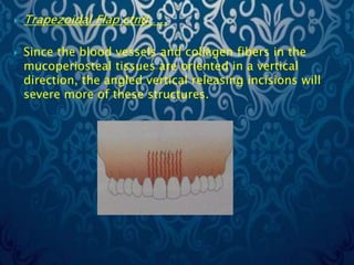 Trapezoidal Incision Surgical endodontics (Apicectomy) by Dr. Amit T. Suryawanshi, Oral ...