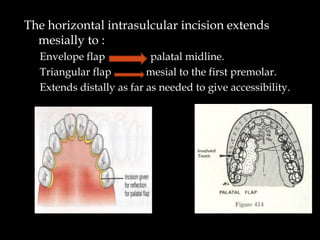 SURGICAL ENDODONTICS IN THE DENTAL FIELD.pptx