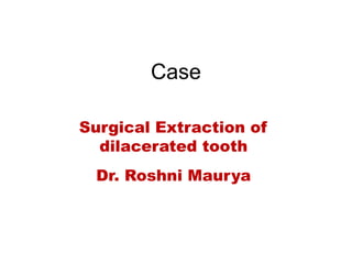 Case
Surgical Extraction of
dilacerated tooth
Dr. Roshni Maurya
 